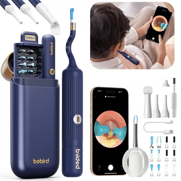 2025 nouveau Otoscope Sans Fil HD & Kit Complet de Nettoyage d’Oreilles